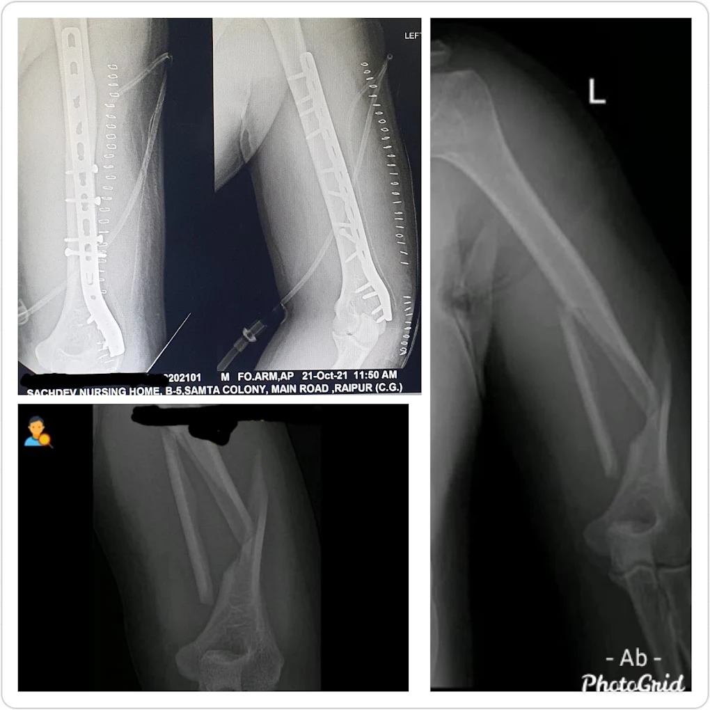 Orthopaedic X-Ray